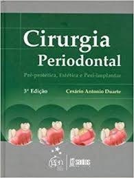 Cirurgia periodontal : pré-protética, estética e peri-implantar