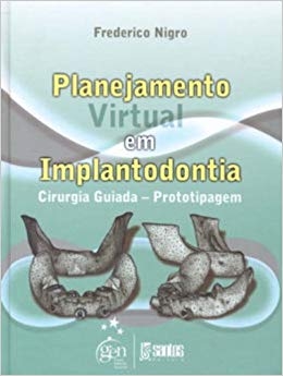 Planejamento virtual em implantologia : cirurgia guiada - prototipagem
