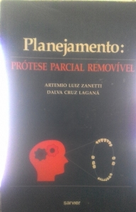 Planejamento : prótese parcial removível