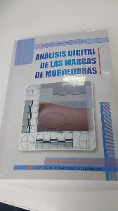 Análisis digital de las marcas de mordedura