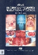 Atlas de cirurgia ortognatica maxilofacial pediatrica