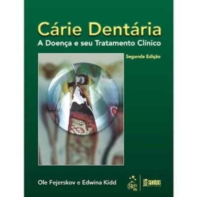 Cárie dentária : a doença e seu tratamento clínico