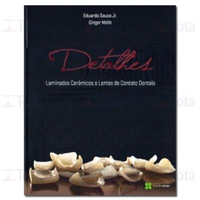 Detalhes : laminados cerâmicos e lentes de contato dentais