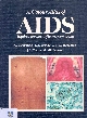 Colours atlas of AIDS : acquired immunodeficiency syndrome