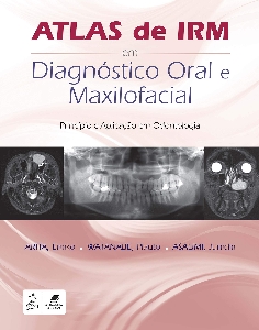 Atlas de IRM em diagnóstico oral e maxilofacial : princípio e aplicação em Odontologia