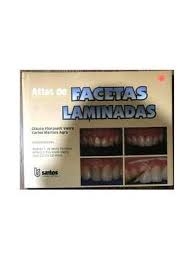 Atlas de facetas laminadas