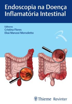 Endoscopia na doença inflamatória intestinal [recurso eletrônico]