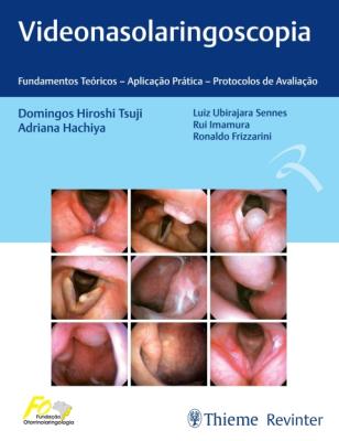 Videonasolaringoscopia [recurso eletrônico] : fundamentos teóricos aplicação prática protocolos de avaliação