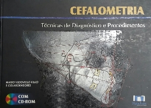 Cefalometria : técnicas de diagnóstico e procedimentos