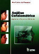 Análise cefalométrica : diagnostico e planejamento ortodôntico