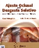 Ajuste oclusal por desgaste seletivo : procedimentos laboratoriais e clínicos