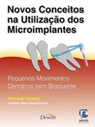Novos conceitos na utilização dos microimplantes : pequenos movimentos dentários sem braquetes